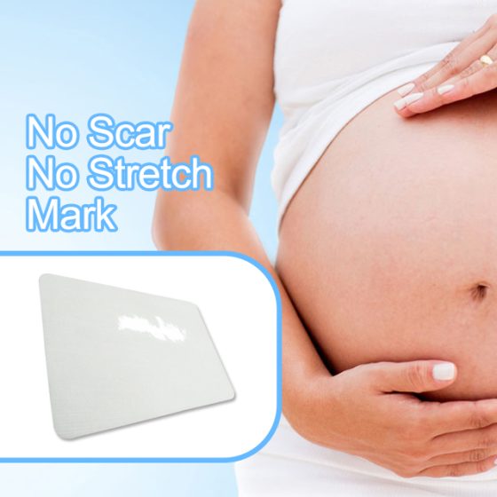 New Product 2024 Companies Looking For Distributors Deep Moisture Stretchmark Patch For Women After Pregnancy